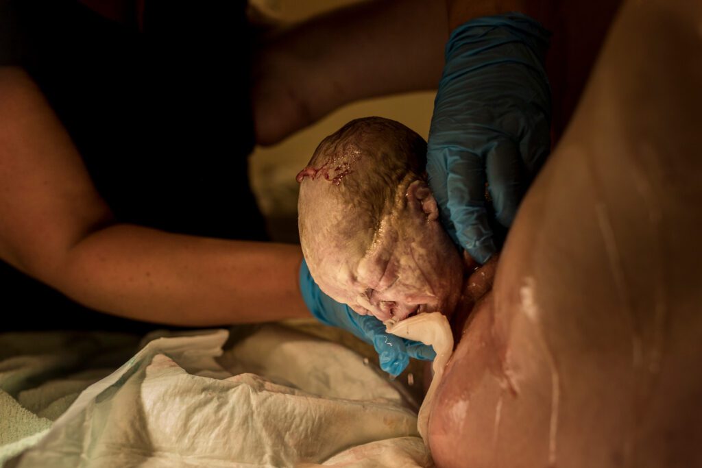 Het hoofdje van de baby wordt geboren.