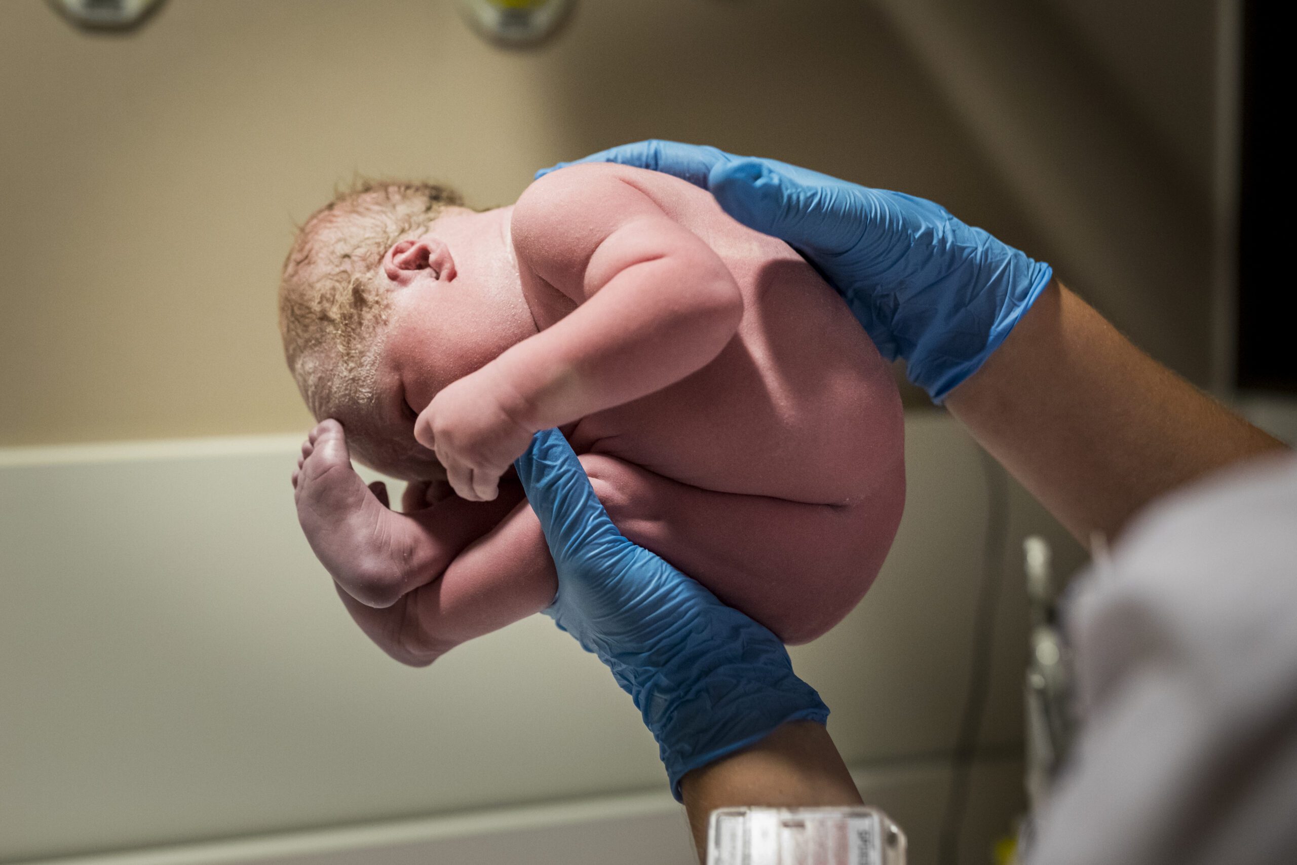 Baby vastgehouden zoals ze in de baarmoeder zat