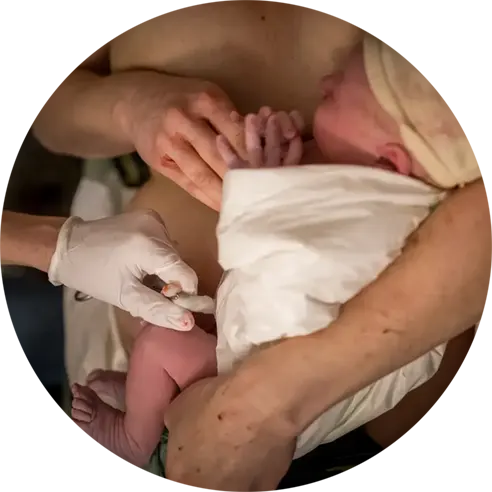 Navelstreng van de pasgeboren baby wordt afgeklemd.